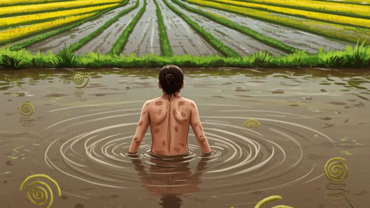 Leptospiroza – ukryte zagrożenie w skażonej wodzie